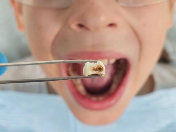 Best Emergency Denture Repair in Oreana, IL